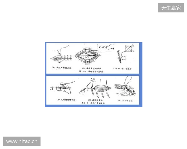 广州豹官方:杨浩眉弓伤口缝合30余针,预计5-7天后拆线